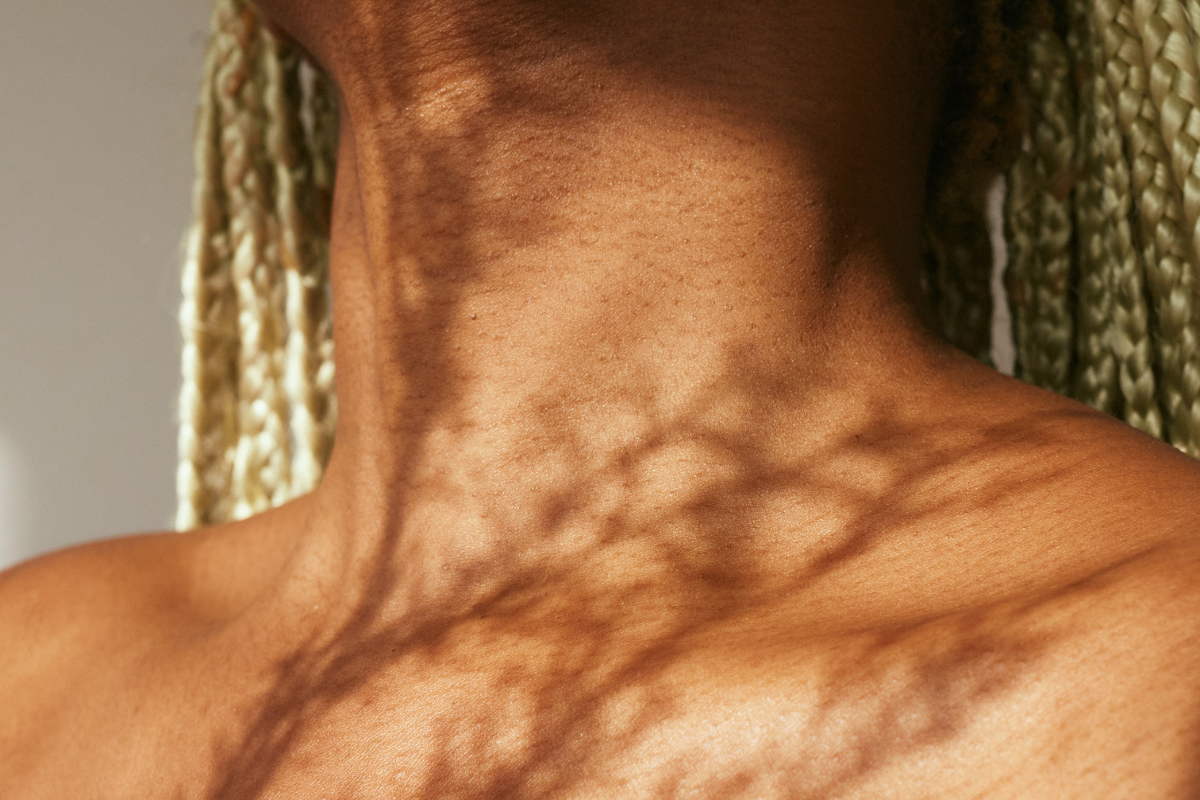 How to Improve Skin Health With Physical Skin Stimulation
